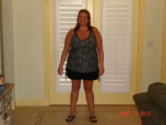 2 months post op down 45 pounds