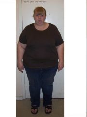 5 days before surgery front