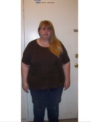 2 weeks post Op front
