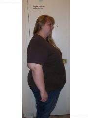 2 weeks post Op Side