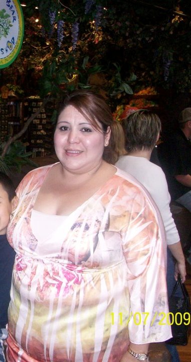 Before WLS surgery