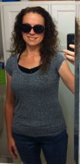 Eight months post-op