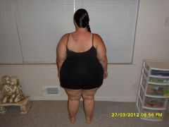 The night before surgery 250lbs