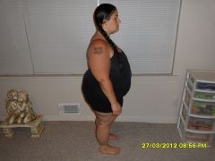 The night before surgery 250lbs