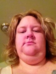 my face before surgery