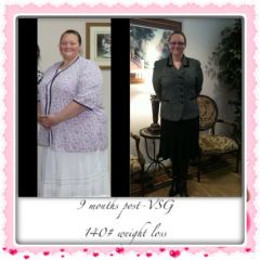 9 month Surgiversary and 140# down