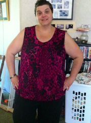 5 19  2 weeks post Op  285.3