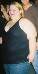 Ugh This is me before I had my surgery at my heaviest 292lbs