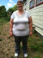 Just Before Surgery 6/23/12