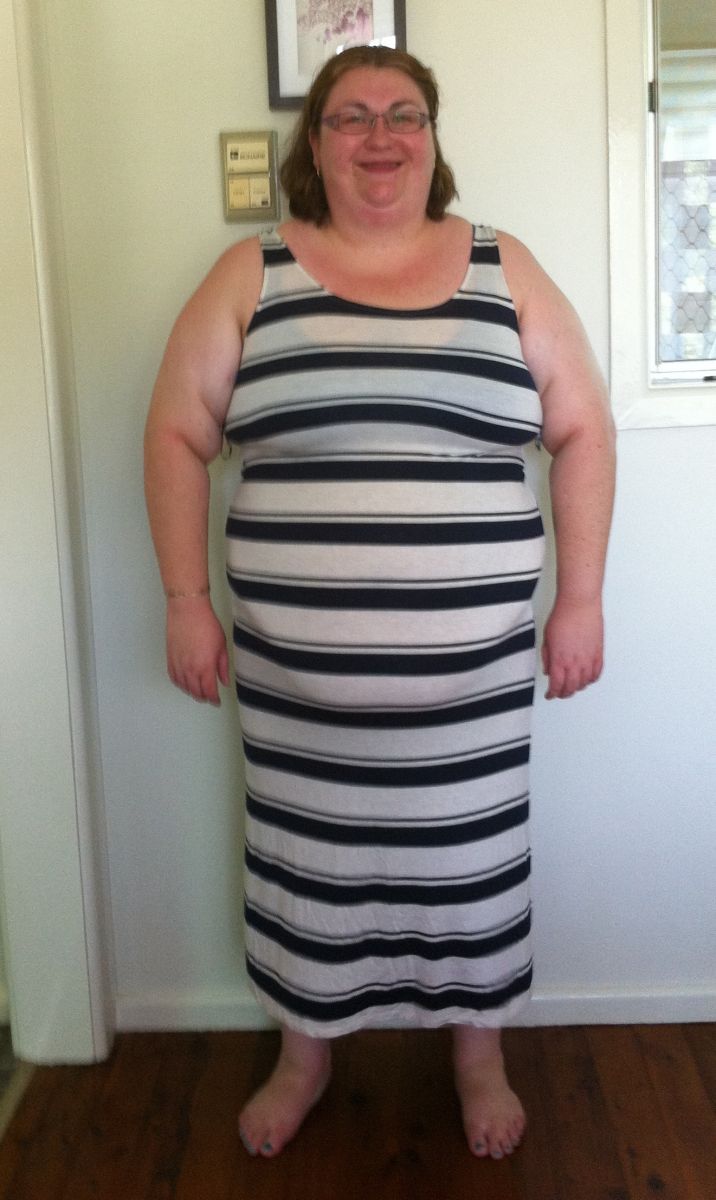 Before Surgery Photos