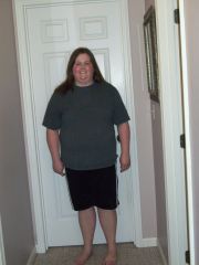 Pre Op - April 10, 2012 - Front View