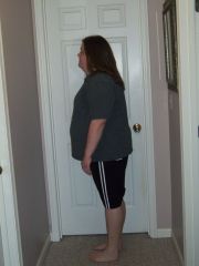 Pre Op - April 10, 2012 - Side View