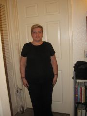 post Op 1 month front