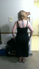 11 month post Op 5 11 13 back