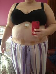 Pre Op