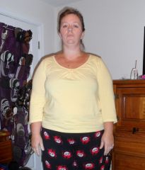 2 weeks post Op front