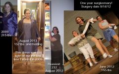 surgiversary Pic