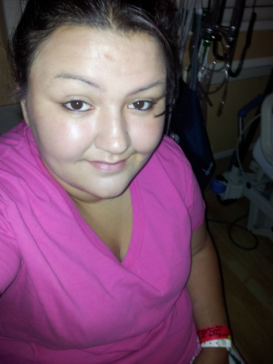 1ST WEEKS POST OP ! :D