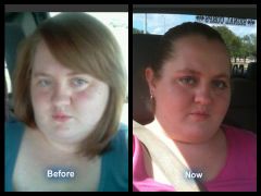 Before and 2 weeks post op