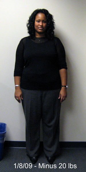 Tmg333 - AFTER Surgery
