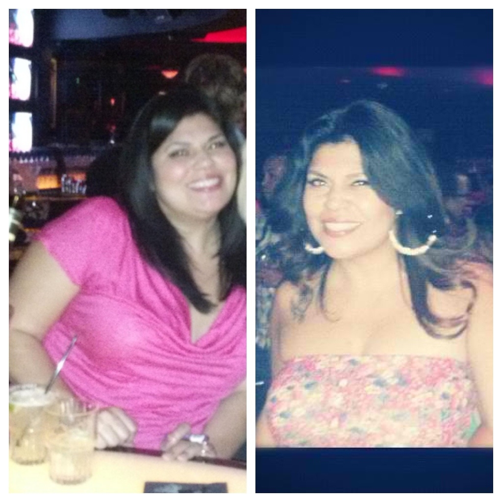 Before and After