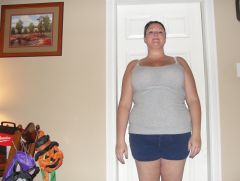 9/30/12   8 weeks post op