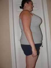 8 weeks post-op