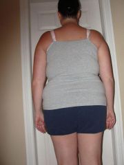 8 weeks post op