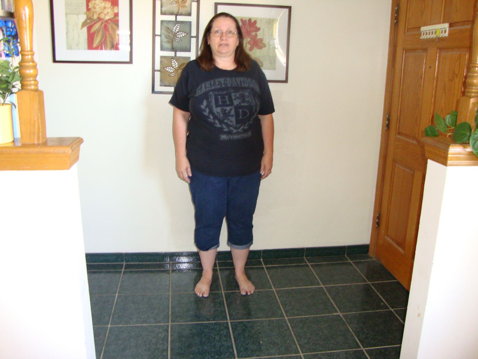 Pre Weight Loss