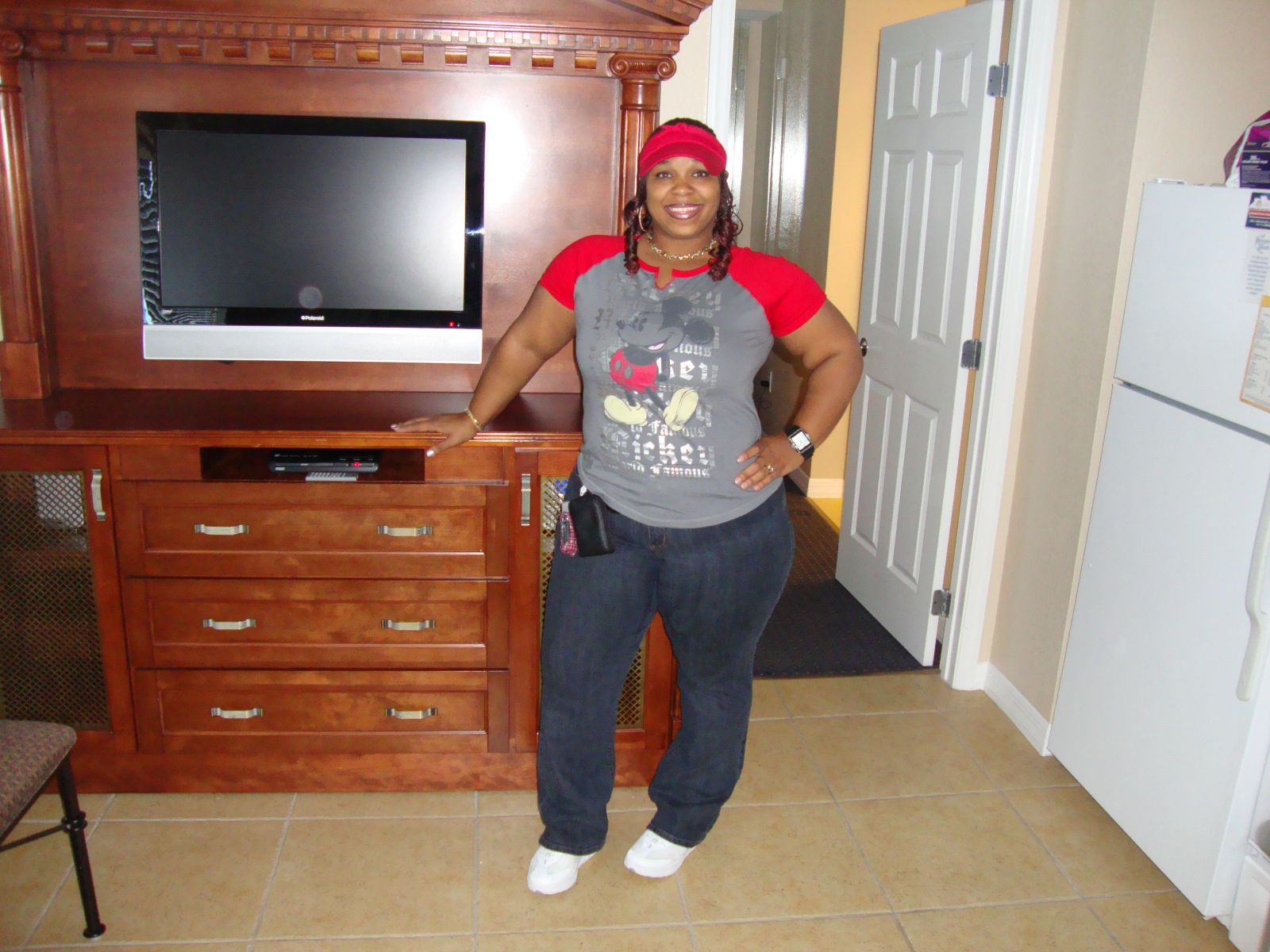 Before Surgery Pics