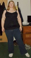 4 days pre-op front