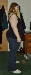 4 days pre-op side