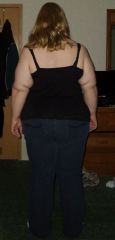 4 days pre-op back