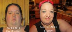 Face 5 months out