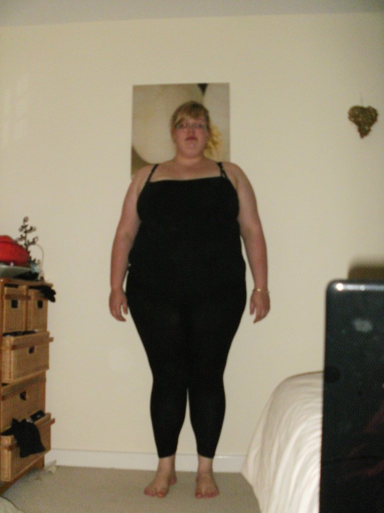 wls pre op to 52 weeks