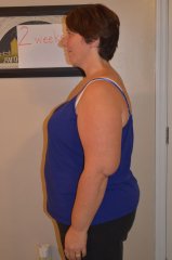 2 weeks post-op