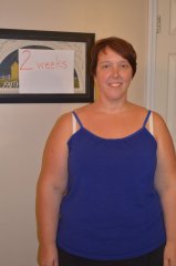 2 weeks post-op