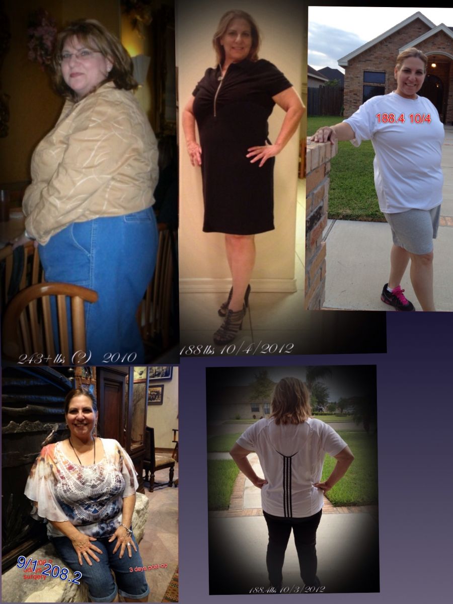 Wgt loss journey 