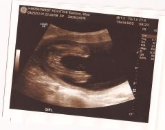 4 months 3 weeks And 3 days0006