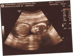 4 months 3 weeks And 3 days0008