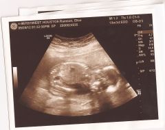 4 months 3 weeks And 3 days0009
