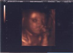 6 months 2 weeks 3 days (2)