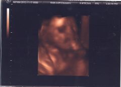 6 months 2 weeks 3 days (3)