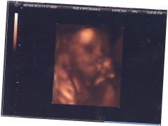 6 months 2 weeks 3 days (4)