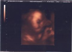6 months 2 weeks 3 days (5)