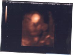 6 months 2 weeks 3 days (6)