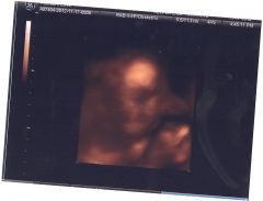6 months 2 weeks 3 days (7)