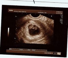 7 weeks