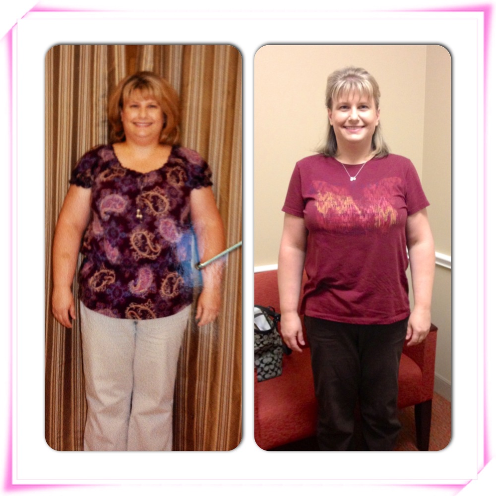 Before/After Picture 