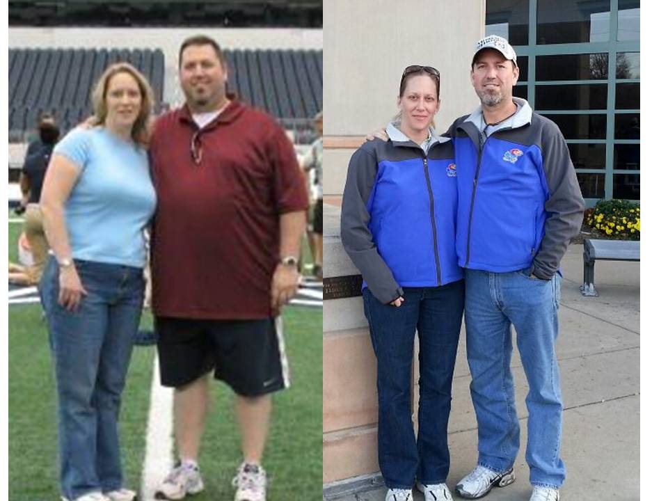 Before and After